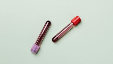 scam caller analysis report